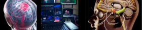 Neuro blog image