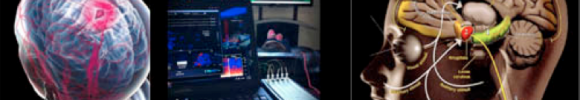 Neuro blog image