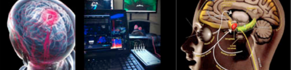 Neuro blog image